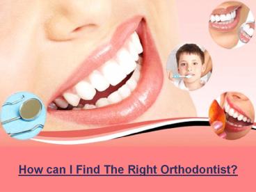 How can I Find The Right Orthodontist?