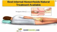 Best Internal Hemorrhoids Natural Treatment Available
