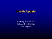 Uveitis Update