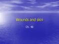 Wounds and skin PowerPoint PPT Presentation