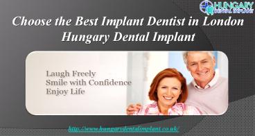 Choose the Best Implant Dentist in London | Hungary Dental Implant