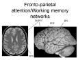Fronto-parietal attention/Working memory networks PowerPoint PPT Presentation