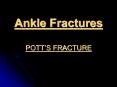 Ankle Fractures POTT PowerPoint PPT Presentation