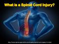 Spinal Cord Injury & Treatment PowerPoint PPT Presentation