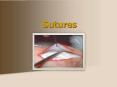 Sutures PowerPoint PPT Presentation