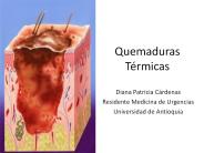 Quemaduras T