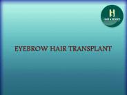 Eye Brow Hair Transplant (1)