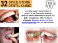 Finest Cosmetic dentist for Teeth Bleaching in Delhi PowerPoint PPT Presentation