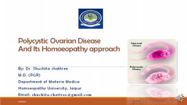 Polycystic ovarian disease by Dr.Shuchita chattree