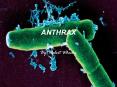 ANTHRAX PowerPoint PPT Presentation