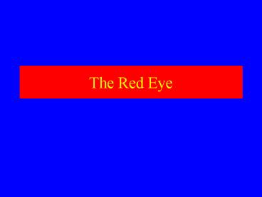 The Red Eye