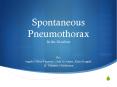 Spontaneous Pneumothorax In the Newborn PowerPoint PPT Presentation