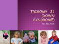 Trisomy 21 (Down Syndrome) PowerPoint PPT Presentation