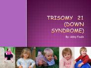 Trisomy 21 (Down Syndrome)