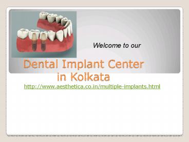 dental implant center in Kolkata