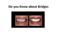 Do you Know about Bridges
