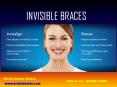 Invisible Braces