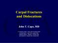 Carpal Fractures and Dislocations PowerPoint PPT Presentation