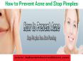 How to Prevent Acne and Stop Pimples PowerPoint PPT Presentation