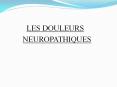 LES DOULEURS PowerPoint PPT Presentation