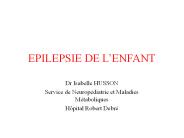 EPILEPSIE DE L