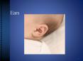 Ears PowerPoint PPT Presentation