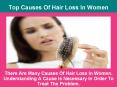 Top Causes Of Hair Loss In Women PowerPoint PPT Presentation