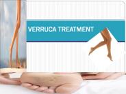 VERRUCA TREATMENT