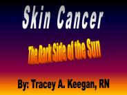 Skin Cancer