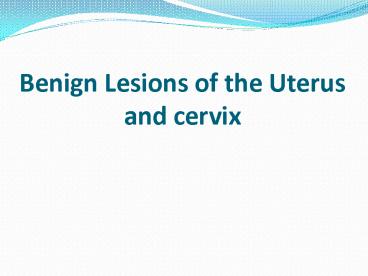 Benign Lesions of the Uterus and cervix