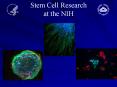 Stem Cell Research at the NIH PowerPoint PPT Presentation