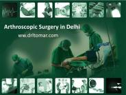 Arthroscopic Surgery in Delhi