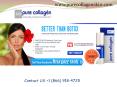 Best Wrinkle Cream-Collagen Supplements, Hair and Weight Loss Treatment PowerPoint PPT Presentation