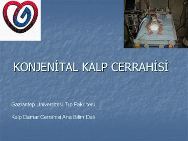 KONJENITAL KALP CERRAHISI