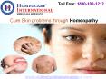Skin infections Cured through Homeopathic Medicine PowerPoint PPT Presentation