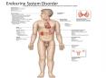 Endocrine System Disorder PowerPoint PPT Presentation