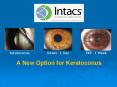 A New Option for Keratoconus PowerPoint PPT Presentation