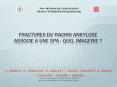 FRACTURES DU RACHIS ANKYLOSE ASSOCIE A UNE SPA PowerPoint PPT Presentation