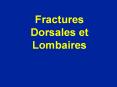 Fractures Dorsales et Lombaires PowerPoint PPT Presentation