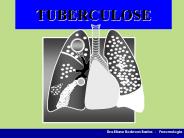 TUBERCULOSE