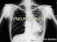 PNEUMOT PowerPoint PPT Presentation