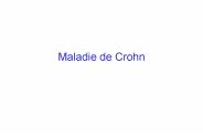 Maladie de Crohn