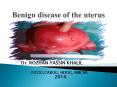 Benign disease of the uterus PowerPoint PPT Presentation