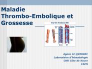Maladie Thrombo-Embolique et Grossesse