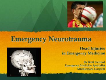 Emergency Neurotrauma