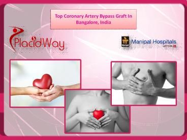 Top Coronary Artery Bypass Graft in Bangalore, India