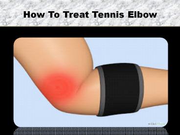 How To Treat Your Tennis Elbow (1)