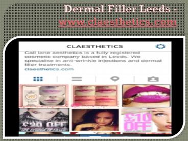 Dermal Filler Leeds - www.claesthetics.com