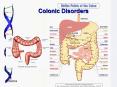 Colonic Disorders PowerPoint PPT Presentation