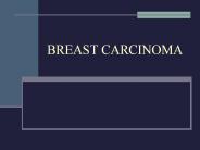 BREAST CARCINOMA